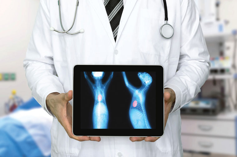 Two x-ray images are displayed on a tablet