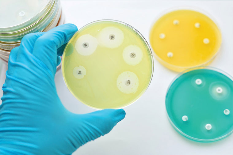 Gloved hand holding an antimicrobial susceptibility testing petri dish with other petri dishes on a table