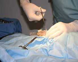 Dr. Wallman performs surgery